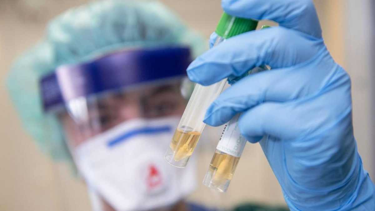 Өткен тәулікте 1392 адам коронавирус індетінен емделіп шықты