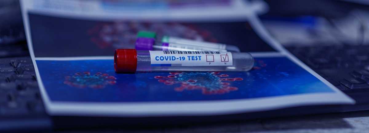 Қазақстанда 71 адам коронавирус инфекциясына шалдықты