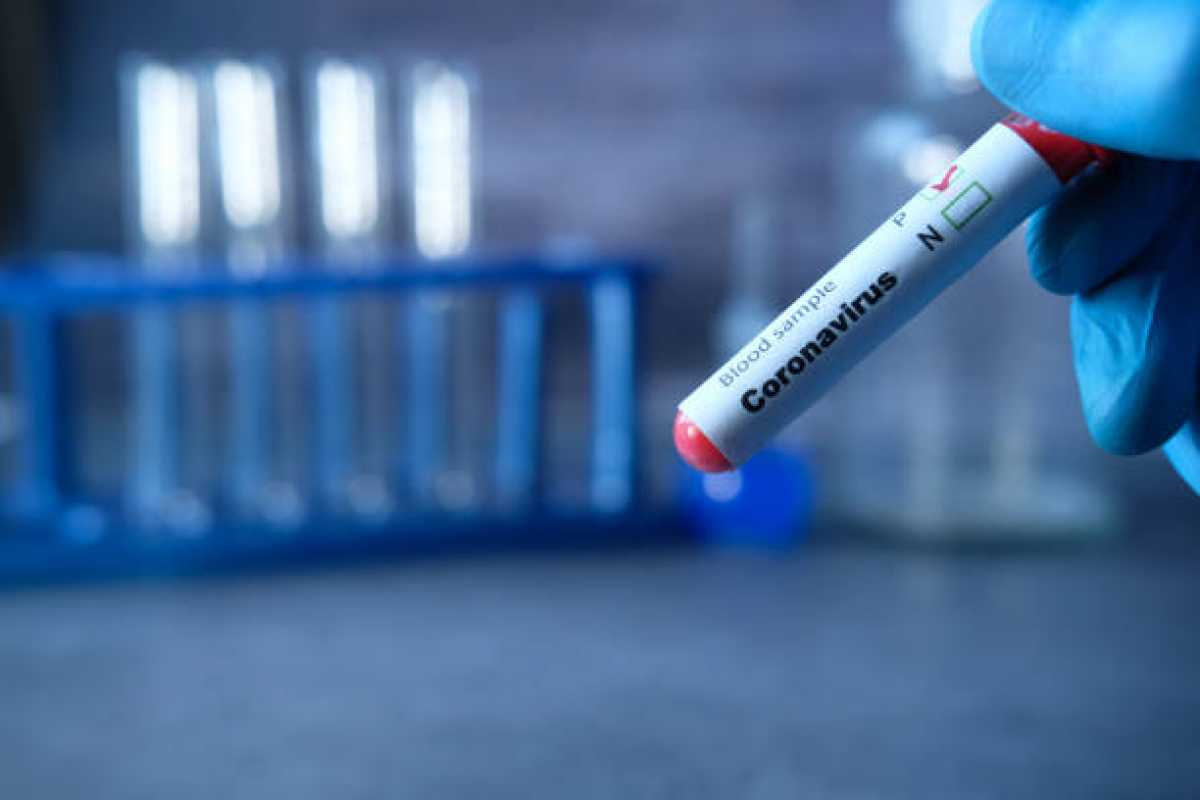 ҚР-да 63 адам коронавирус инфекциясына шалдықты